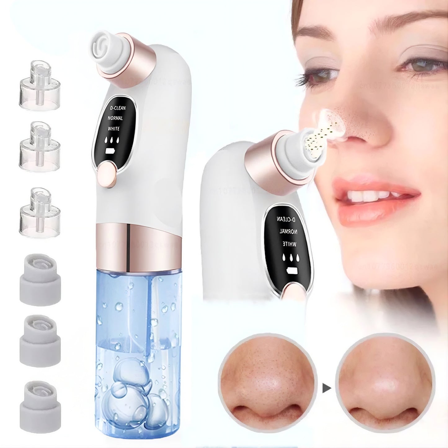 blackhead remover
