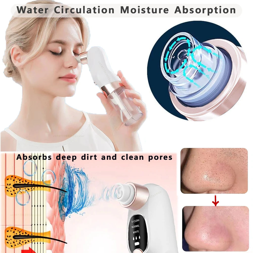 blackhead remover