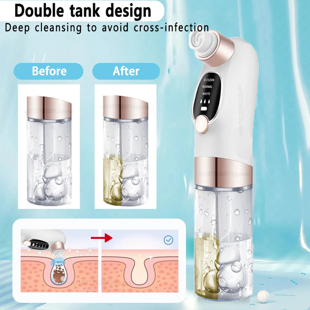 blackhead remover