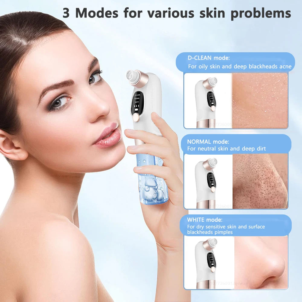 blackhead remover